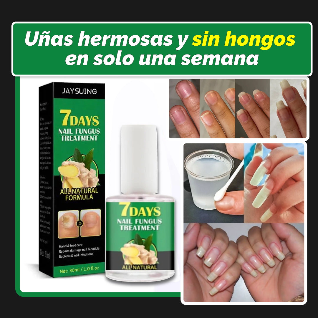 Esmalte eliminador de hongos en las uñas - Fórmula antifúngica de resultado en 7 DÍAS💥HOY 50% DCTO